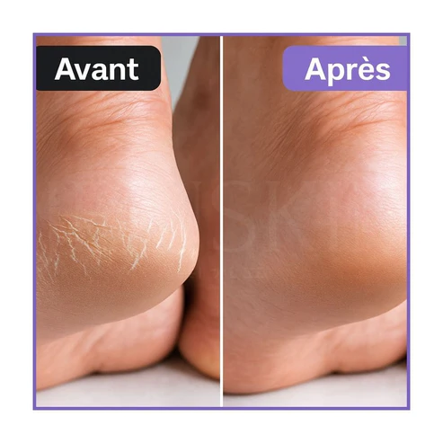 Baren — Patch de talon de couchage au beurre de karité - 10pièces – Image 2