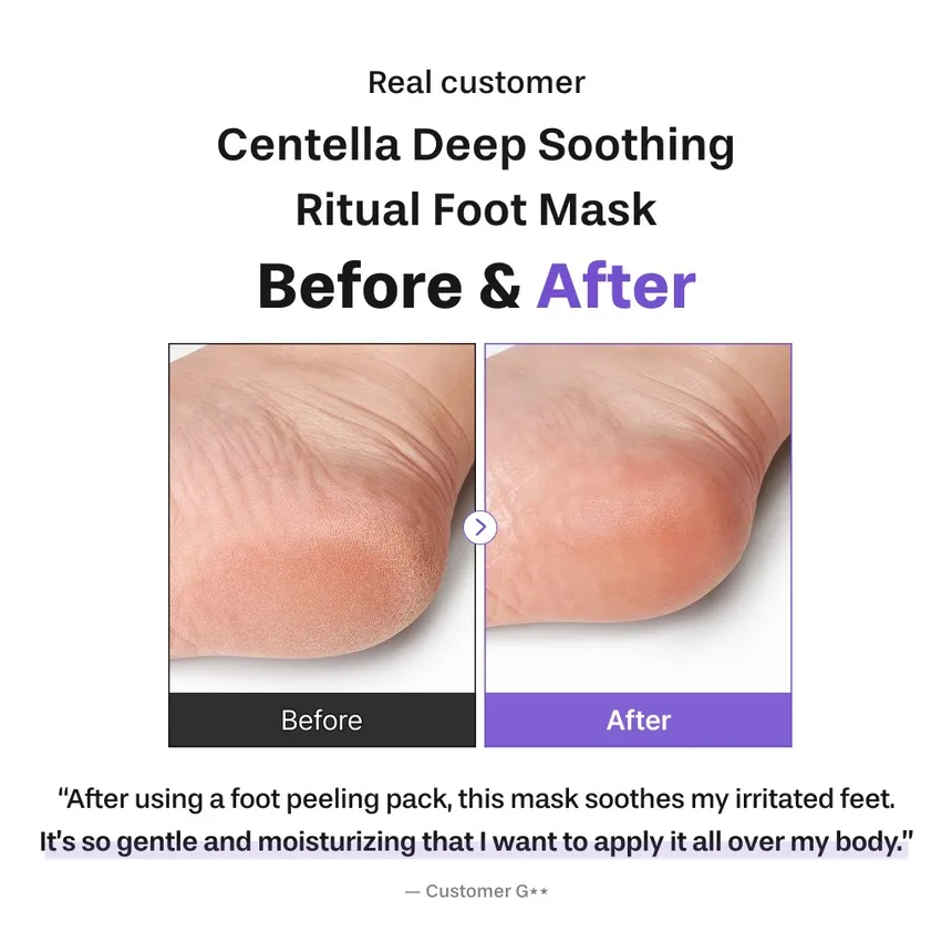 Baren — Masque pour les pieds à réparation rapide CICA SOS - 3pièces – Image 2