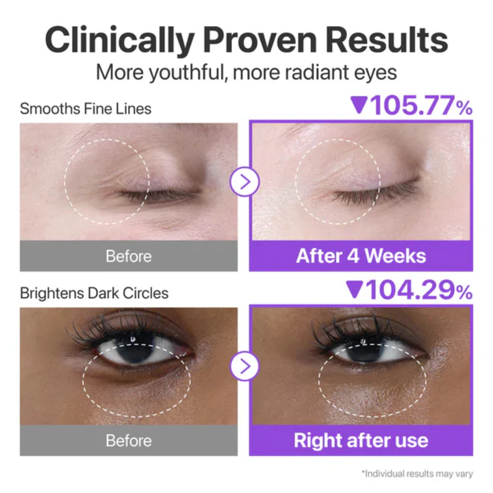 numbuzin - Crème contour des yeux Volumetox au rétinol NAD+ n° 9 - 10ml – Image 5