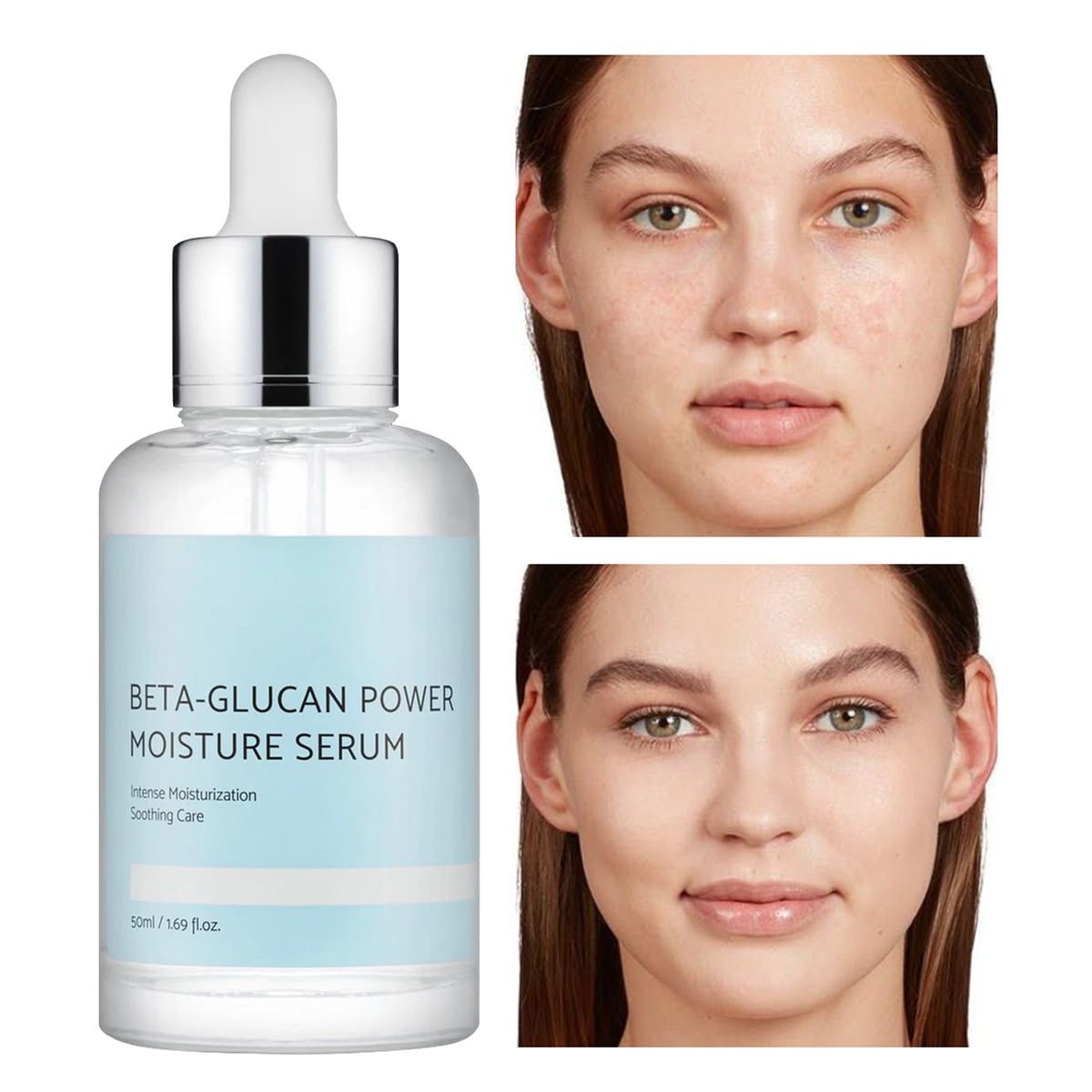 iUNIK - Beta-Glucan Power Moisture Serum - Sérum hydratant – Image 2